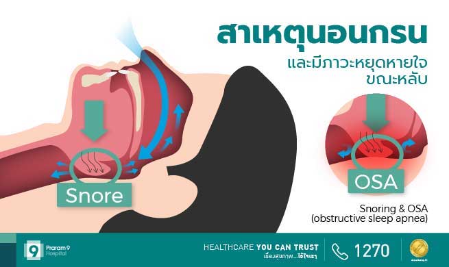 OSA-Snore